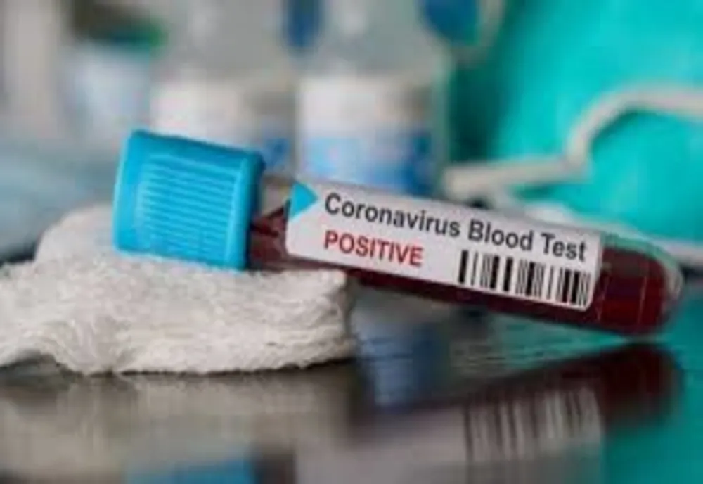 Autoritățile au anunțat, cu puțin timp în urmă, noi decese, în România, ca urmare a infecției cu coronavirus. Bilanțul deceselor în România - 203