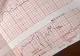 Noua BOALĂ a românilor: tot mai multe persoane ajung la spital. Cum se MANIFESTĂ și care este PRINCIPALA CAUZĂ
